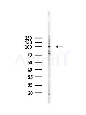 RBM15 Antibody - Western blot analysis of lysates from A375 cells(starvation,24h treatment), using RBM15 Antibody at 1/1000 dilution.