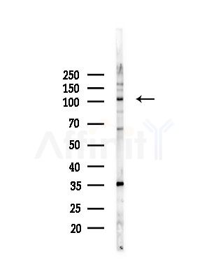 RBM15 Antibody - Western blot analysis of lysates from PC12 cells(LPS, 4h treatment), using RBM15 Antibody at 1/1000 dilution.