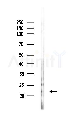REEP5 Antibody - Western blot analysis of lysates from MCF7 cells(heat-shock,45min treatment), using REEP5 Antibody at 1/1000 dilution.