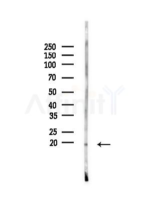CHCHD2 Antibody - Western blot analysis of lysates from Mouse testis, using CHCHD2 Antibody at 1/1000 dilution.