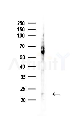 COMMD1 Antibody - Western blot analysis of lysates from MCF7 cells(heat-shock,45min treatment), using COMMD1 Antibody at 1/1000 dilution.