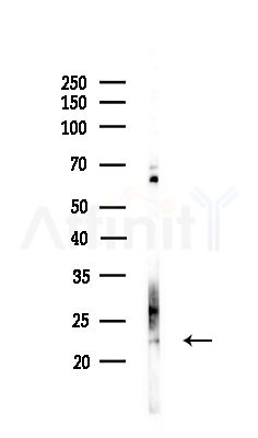 COMMD1 Antibody - Western blot analysis of lysates from COLO205 cells(UV,30min treatment), using COMMD1 Antibody at 1/1000 dilution.