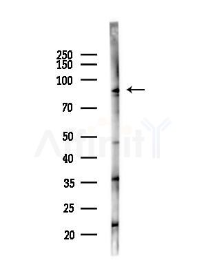 DDX21 Antibody - Western blot analysis of lysates from LoVo cells(heat-shock,45min treatment), using DDX21 Antibody at 1/1000 dilution.