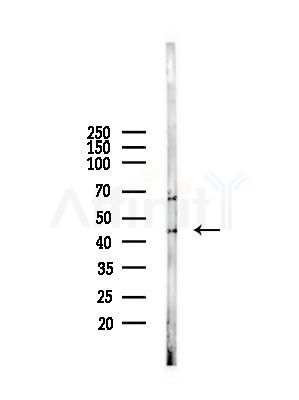 eIF4A3 Antibody - Western blot analysis of lysates from A375 cells(starvation,24h treatment), using eIF4A3 Antibody at 1/1000 dilution.