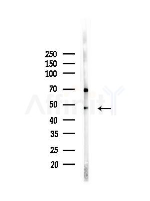 eIF4A3 Antibody - Western blot analysis of lysates from PC12 cells(LPS, 4h treatment), using eIF4A3 Antibody at 1/1000 dilution.