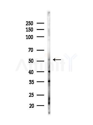 ERAL1 Antibody - Western blot analysis of lysates from Hela cells(heat-shock,45min treatment), using ERAL1 Antibody at 1/1000 dilution.