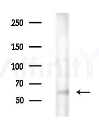 FKBP65 Antibody - Western blot analysis of extracts from EC304 cells(heat-shock treatment), using FKBP65 Antibody at 1/1000 dilution.