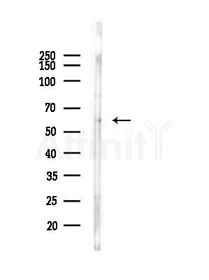 FKBP65 Antibody - Western blot analysis of lysates from EC304 cells(heat-shock, 45min treatment), using FKBP65 Antibody at 1/1000 dilution.