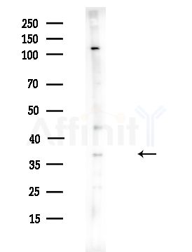 MAT2B Antibody - Western blot analysis of lysates from HUVEC cells(UV,30min treatment), using MAT2B Antibody at 1/1000 dilution.