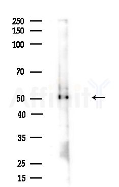 OXCT1 Antibody - Western blot analysis of lysates from Mouse brain, using OXCT1 Antibody at 1/1000 dilution.