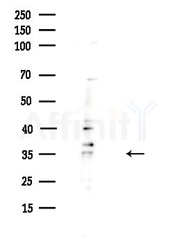 RNase H1 Antibody - Western blot analysis of lysates from HUVEC cells(UV,30min treatment), using RNase H1 Antibody at 1/1000 dilution.