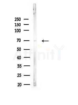 Spartin, SPG20 Antibody - Western blot analysis of lysates from Mouse liver, using Spartin, SPG20 Antibody at 1/1000 dilution.