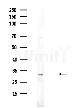 SULT4A1 Antibody - Western blot analysis of lysates from HUVEC cells(UV,30min treatment), using SULT4A1 Antibody at 1/1000 dilution.