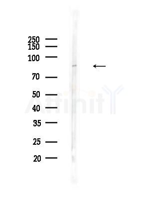 BBS2 Antibody - Western blot analysis of lysates from HepG2 cells(heat-shock,45min treatment), using BBS2 Antibody at 1/1000 dilution.