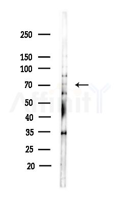 BRD7 Antibody - Western blot analysis of lysates from COLO205 cells(heat-shock,45min treatment), using BRD7 Antibody at 1/1000 dilution.