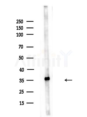 LDHB Antibody - Western blot analysis of lysates from A375 cells(heat-shock,45min treatment), using LDHB Antibody at 1/1000 dilution.