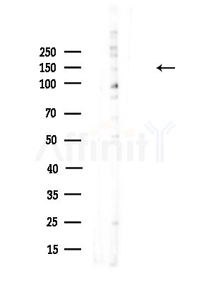 Liprin alpha 1 Antibody - Western blot analysis of lysates from HUVEC cells(UV,30min treatment), using Liprin alpha 1 Antibody at 1/1000 dilution.