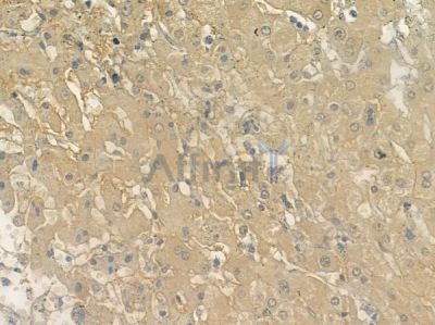 Liprin alpha 1 Antibody - DF12102 at 1/100 staining human normal liver tissue by IHC-P.
