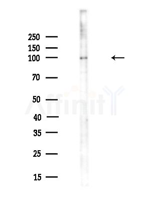 NSUN2 Antibody - Western blot analysis of lysates from A375 cells(heat-shock,45min treatment), using NSUN2 Antibody at 1/1000 dilution.