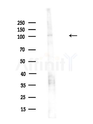 NSUN2 Antibody - Western blot analysis of lysates from HUVEC cells(UV,30min treatment), using NSUN2 Antibody at 1/1000 dilution.