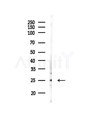 C9orf72 Antibody - Western blot analysis of lysates from Rat brain, using C9orf72 Antibody at 1/1000 dilution.