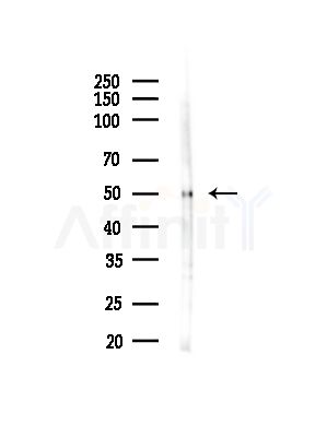 C9orf72 Antibody - Western blot analysis of lysates from Hela cells(starvation,24h treatment), using C9orf72 Antibody at 1/1000 dilution.