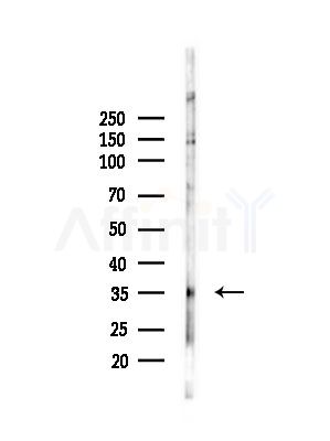 GNMT Antibody - Western blot analysis of lysates from PC12 cells(LPS, 4h treatment), using GNMT Antibody at 1/1000 dilution.