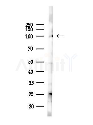 LONP1 Antibody - Western blot analysis of lysates from LoVo cells(heat-shock,45min treatment), using LONP1 Antibody at 1/1000 dilution.