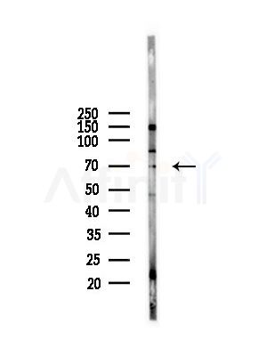 MTA3 Antibody - Western blot analysis of lysates from A375 cells(starvation,24h treatment), using MTA3 Antibody at 1/1000 dilution.