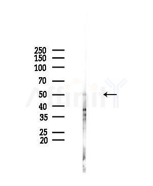 NEU4 Antibody - Western blot analysis of lysates from HUVEC cells(UV,30min treatment), using NEU4 Antibody at 1/1000 dilution.