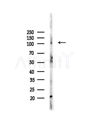 NOD2 Antibody - Western blot analysis of lysates from PC12 cells(LPS, 4h treatment), using NOD2 Antibody at 1/1000 dilution.