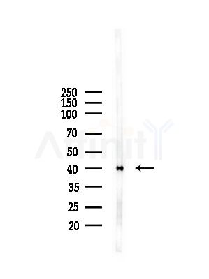 PSAT1 Antibody - Western blot analysis of lysates from A375 cells(starvation,24h treatment), using PSAT1 Antibody at 1/1000 dilution.