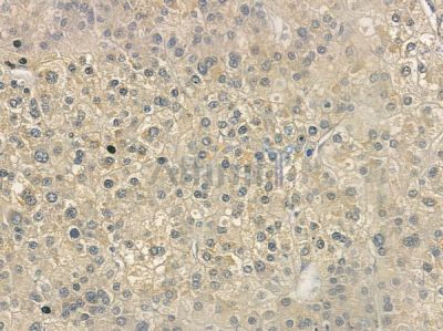 PTPRO Antibody - DF12133 at 1/100 staining human normal lung tissue by IHC-P.