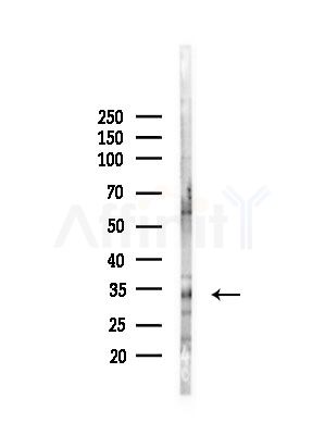 Estrogen Sulfotransferase Antibody - Western blot analysis of lysates from PC12 cells(LPS, 4h treatment), using Estrogen Sulfotransferase Antibody at 1/1000 dilution.