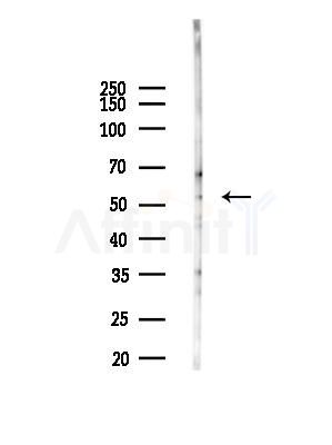 UGT2B7 Antibody - Western blot analysis of lysates from EC304 cells(heat-shock,45min treatment), using UGT2B7 Antibody at 1/1000 dilution.