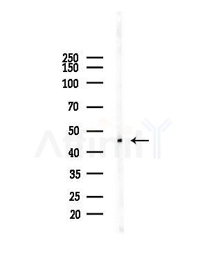 ADRM1 Antibody - Western blot analysis of lysates from EC304 cells(heat-shock,45min treatment), using ADRM1 Antibody at 1/1000 dilution.