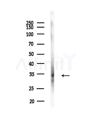 CHMP2A Antibody - Western blot analysis of lysates from B16F10-LUC cells(starvation,24h treatment), using CHMP2A Antibody at 1/1000 dilution.