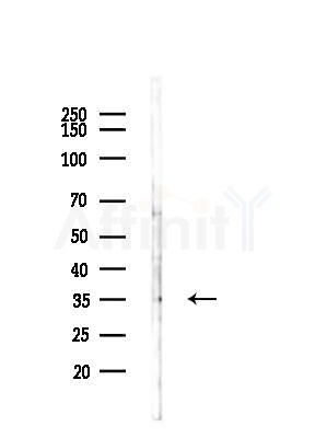 CLTA Antibody - Western blot analysis of lysates from COLO205 cells(UV,30min treatment), using CLTA Antibody at 1/1000 dilution.