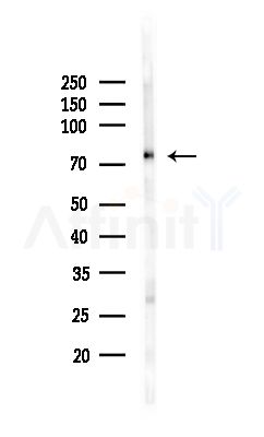 Coilin Antibody - Western blot analysis of lysates from MCF7 cells(heat-shock,45min treatment), using Coilin Antibody at 1/1000 dilution.