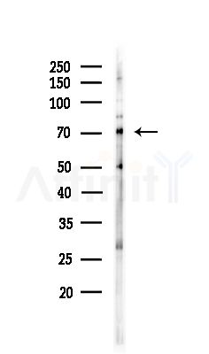 Coilin Antibody - Western blot analysis of lysates from COLO205 cells(UV,30min treatment), using Coilin Antibody at 1/1000 dilution.