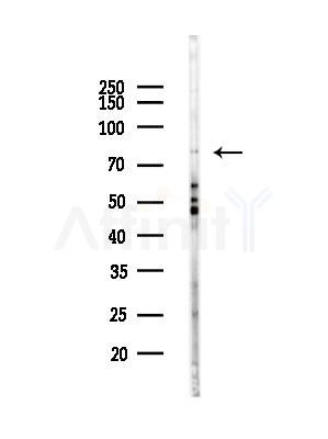 LMOD1 Antibody - Western blot analysis of lysates from EC304 cells(heat-shock,45min treatment), using LMOD1 Antibody at 1/1000 dilution.