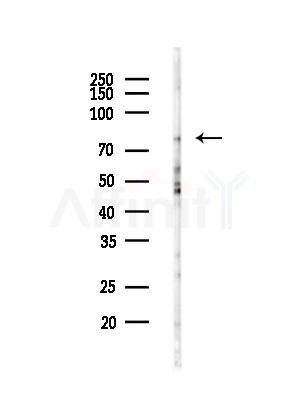 LMOD1 Antibody - Western blot analysis of lysates from HUVEC cells(LPC4h treatment), using LMOD1 Antibody at 1/1000 dilution.