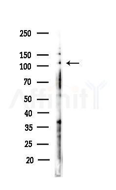 MCM10 Antibody - Western blot analysis of lysates from COLO205 cells(heat-shock,45min treatment), using MCM10 Antibody at 1/1000 dilution.