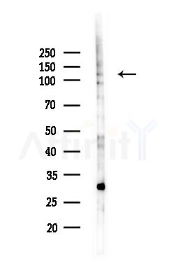 MICAL1 Antibody - Western blot analysis of lysates from MCF7 cells(heat-shock,45min treatment), using MICAL1 Antibody at 1/1000 dilution.