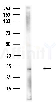 NUDT21 Antibody - Western blot analysis of lysates from HUVEC cells(UV,30min treatment), using NUDT21 Antibody at 1/1000 dilution.