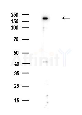 PTPN23 Antibody - Western blot analysis of lysates from A375 cells(heat-shock,45min treatment), using PTPN23 Antibody at 1/1000 dilution.