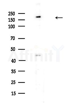 PTPN23 Antibody - Western blot analysis of lysates from HUVEC cells(UV,30min treatment), using PTPN23 Antibody at 1/1000 dilution.