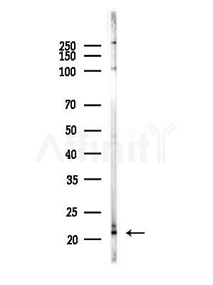 TAF12 Antibody - Western blot analysis of lysates from PC12 cells(LPS,4h treatment), using TAF12 Antibody at 1/1000 dilution.