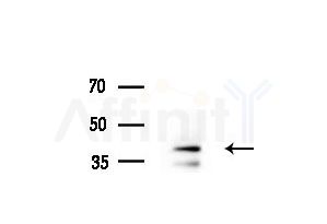 TIA1 Antibody - Western blot analysis of extracts from COLO205 cells(heat-shock treatment), using TIA1 Antibody at 1/1000 dilution.