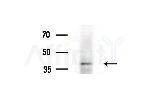 TIA1 Antibody - Western blot analysis of extracts from HepG2 cells(heat-shock treatment), using TIA1 Antibody at 1/1000 dilution.